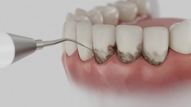 Trusted Root Canal Treatment service in Central Gardens, TX - Dentist Open Now